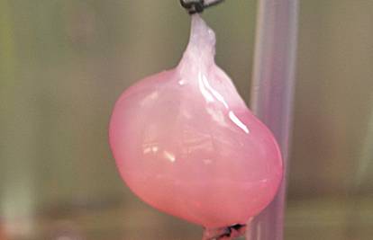 Korak do kreiranja organa: U laboratoriju oživio stari bubreg