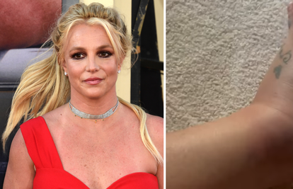 Britney Spears nakon incidenta pokazala natečeno stopalo: 'Za sve je kriva moja mama...'