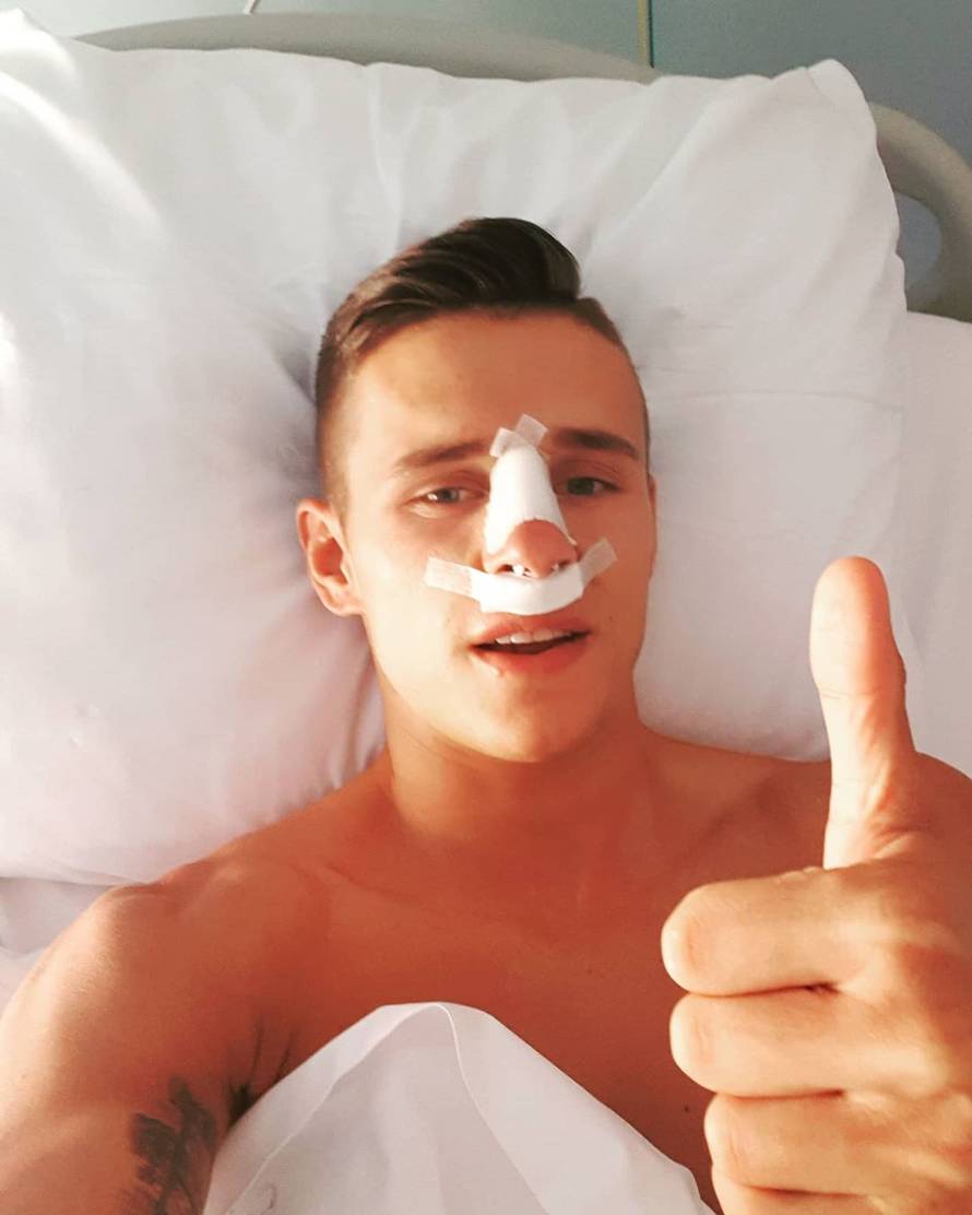 Kadzioru slomljen nos na dva mjesta: Ne sjećam se situacije