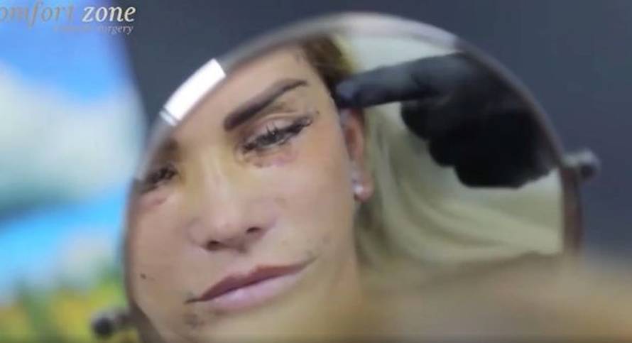 Starleta opet šokira: Cijela je u zavojima, smanjila je i grudi...