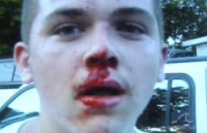 SAD: Banda huligana brutalno pretukla dječaka