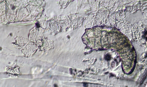 Jeste li znali? Ova se bića pare na vašem licu dok spavate...