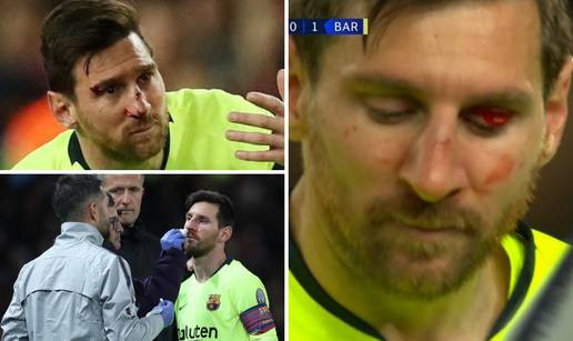 Leo Messi upoznao Smallinga: 'Krvari, znači da je ipak čovjek'