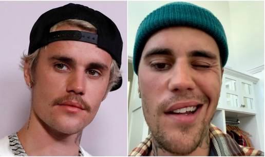 Bieber se nakon paralize lica povukao, ali sad se vraća glazbi