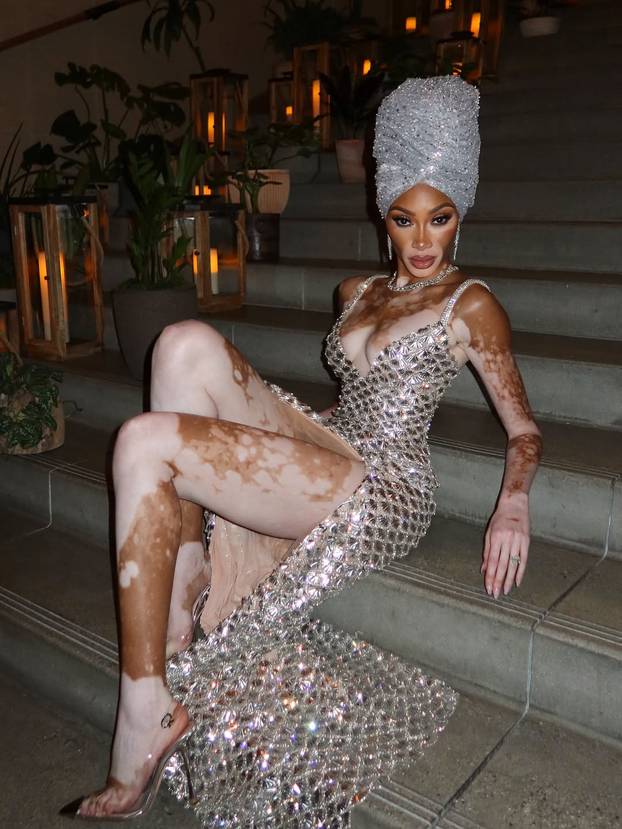 FOTO Rugali su joj se zbog bolesti, a danas je obožavaju zbog jedinstvenog izgleda