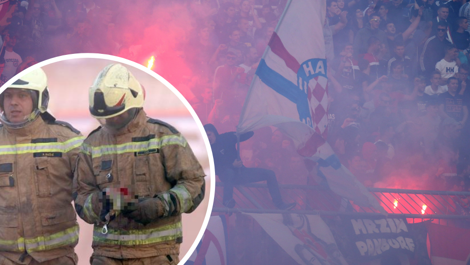 Odšteta vatrogascu može biti i 250.000 kn, a plaća je Hajduk