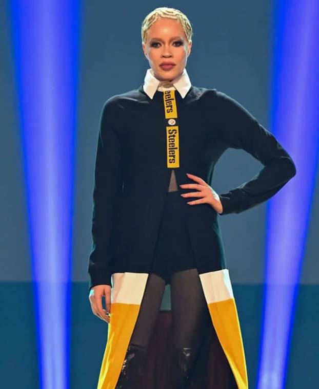 FOTO Afrikanka s albinizmom osvaja modnu industriju: 'Često privlačim znatiželjne poglede'