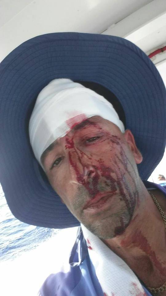 Kit udario u turističku brodicu: 'Nitko nije znao što se događa'