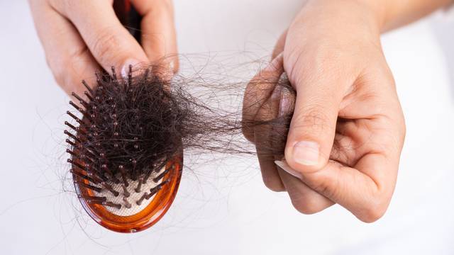 Najbolje metode za pranje četki za kosu: Evo što vam sve treba