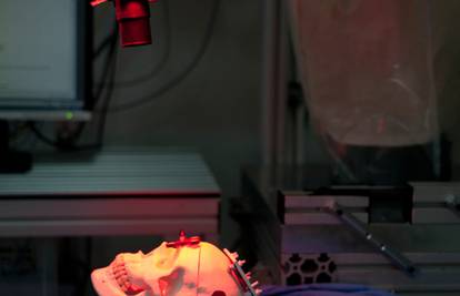 RONNA je prvi hrvatski robot koji će operirati tumore mozga