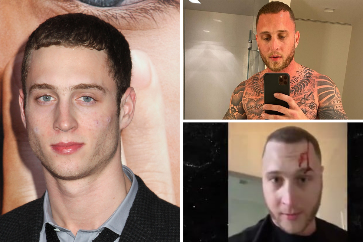 Hanksov problematični sin Chet (30) krvave glave optužio bivšu curu: 'Ona me je napala nožem'