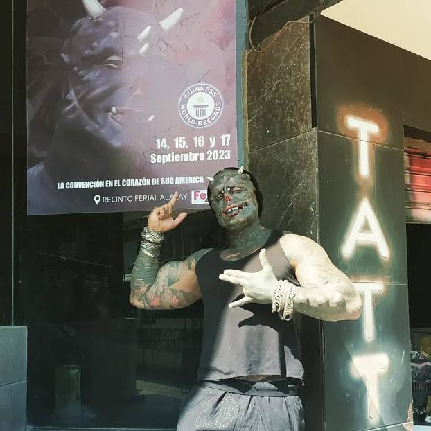 FOTO Uznemirujuće! Uklonila je čak i vrh nosa, a evo kako je izgledala: Šteta, ljepotica si bila