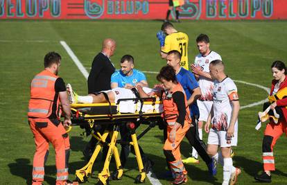 Detalji stravične ozljede igrača Gorice: Ima potres mozga i višestruki prijelom kostiju lica