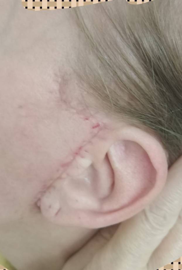 Na istog se estetskog kirurga žalila i Kristina Mandarina. Pogledajte kako je izgledala