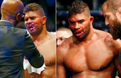 Uznemirujuće! Overeem nakon nokauta ostao bez dijela usne