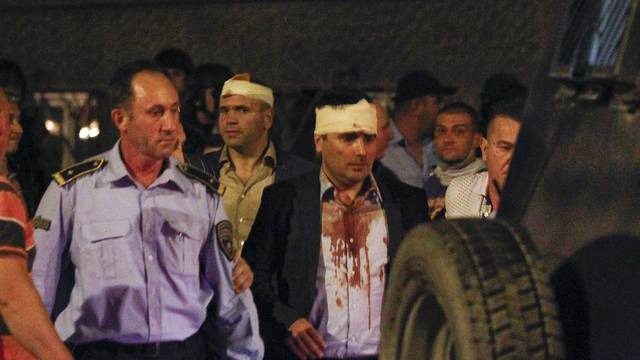 Macedonian police escorts injured members of the parliament including Social Democratic leader Zoran Zaev