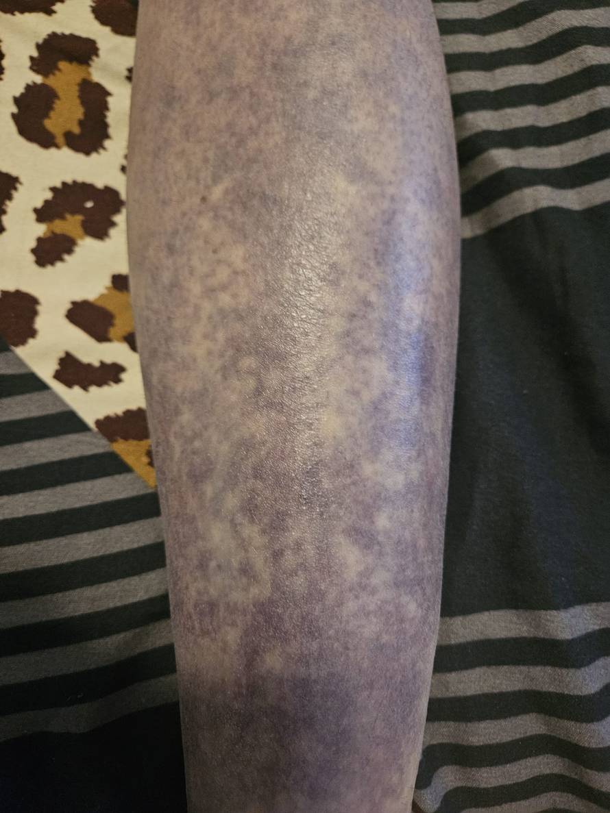 Super Silva za 24sata: Znam tko me napao, bilo je iznenada i s leđa. Jedna noga mi je uništena