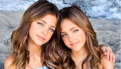 Upoznajte Avu i Leah (9): Jesu li ovo najljepše blizanke svijeta