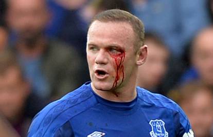 Rooney je krvario za preokret Evertona! 'Redsi' srušili 'lisice'