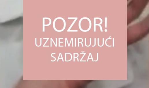 Pa što je taj čovjek radio? Ovo je uvjerljivo najgori žulj - ikad