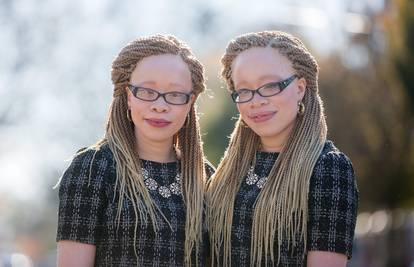 Albino blizanke Instagram hit: 'Volimo našu kožu, lijepe smo'