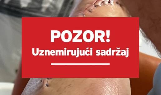 Stra&scaron;na ozljeda potresla Arenu, borac se javio nakon operacije: 'FNC mi je platio lije&ccaron;enje...'