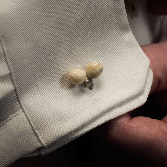 Neobični materijali: Dizajnerica napravila nakit od ljudskih zubi