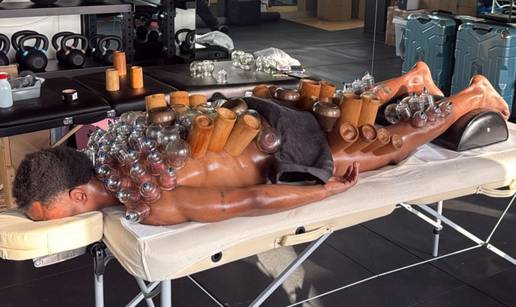 Ovo je Juventusova zvijezda. Pogledajte kako se oporavlja