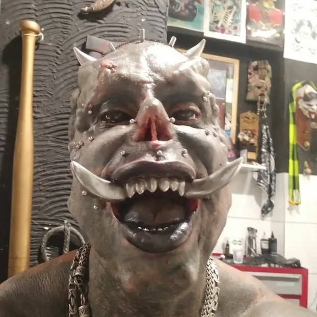 FOTO Uznemirujuće! Uklonila je čak i vrh nosa, a evo kako je izgledala: Šteta, ljepotica si bila