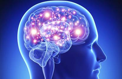 Spriječiti se može 90 posto moždanih udara - prevencijom