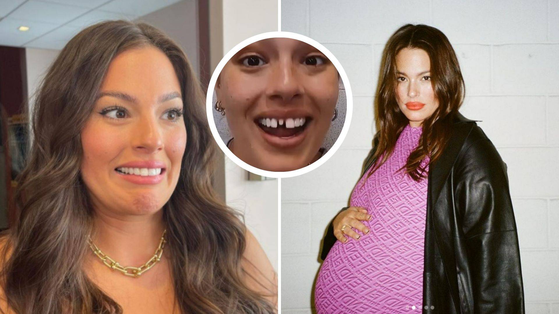 Ashley Graham ostala bez zuba: 'Udario me glavom i ispao je!'