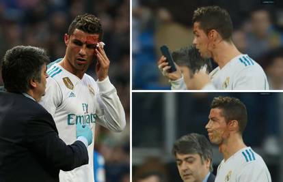 Ronaldo dobio nogom u glavu pa se krvav ogledao u mobitelu