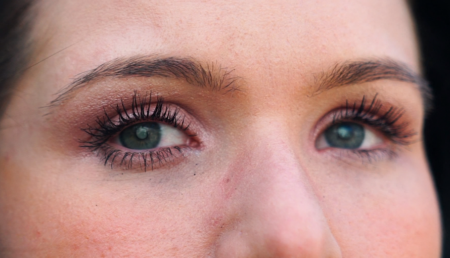 Ana (26): 'Otišla sam spavati i ujutro se probudila slijepa'