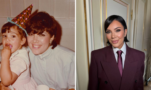 FOTO Zahvate i operacije Kris ne skriva: Evo što je sve radila...