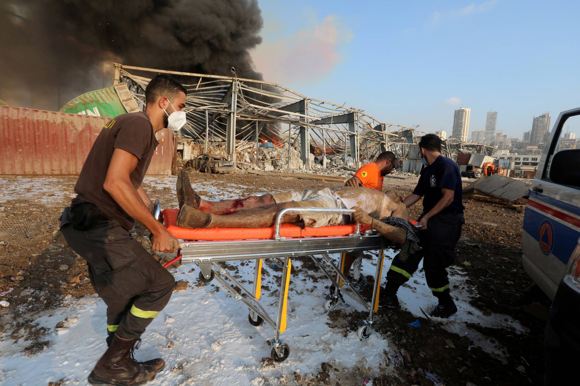 SENSITIVE MATERIAL. THIS IMAGE MAY OFFEND OR DISTURB. An injured man is transported on a stretcher following an explosion in Beirut