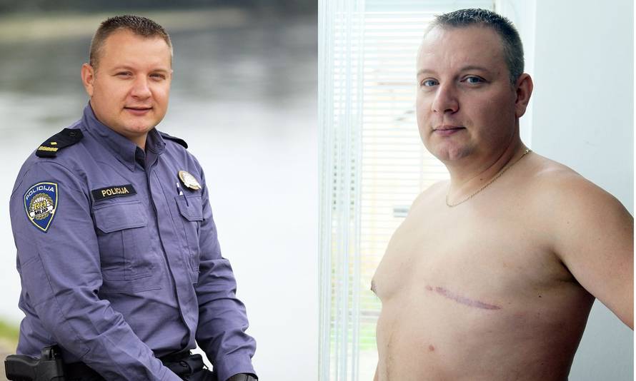 'Imao sam rak dojke, dijagnozu sam čekao predugih 7 godina'