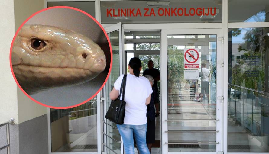 U splitskom KBC-u vrištali od straha: Stigli nepozvani 'gosti'