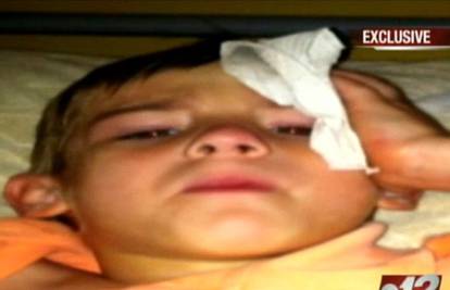 'Vidio sve zvijezde': Dječaka u glavu pogodio djelić meteorita