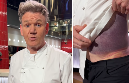 Gordon Ramsay doživio tešku biciklističku nesreću: 'Da nisam nosio kacigu ne bih bio ovdje'