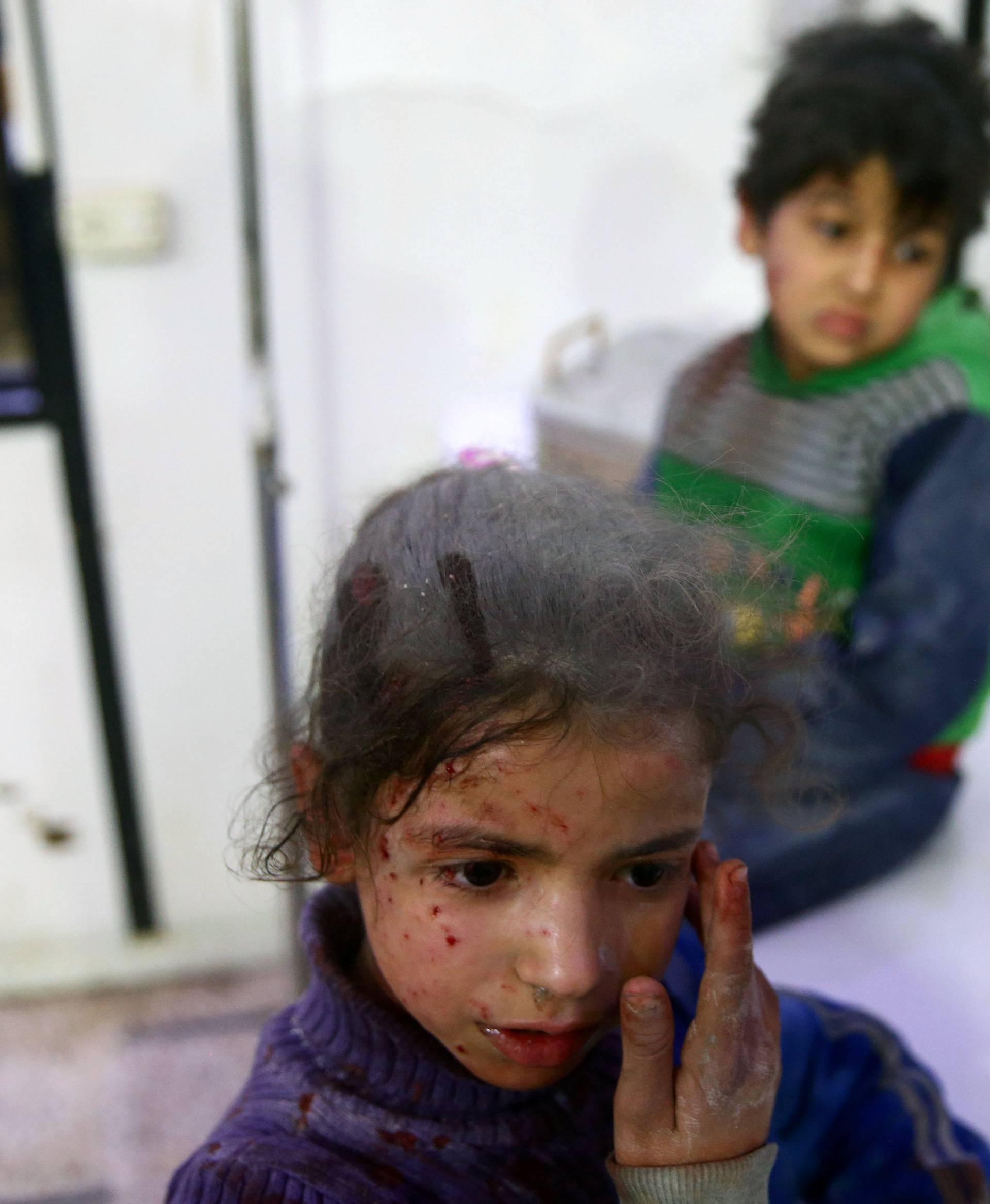 Wounded children are seen in a hospital in the besieged town of Douma, Eastern Ghouta, Damascus