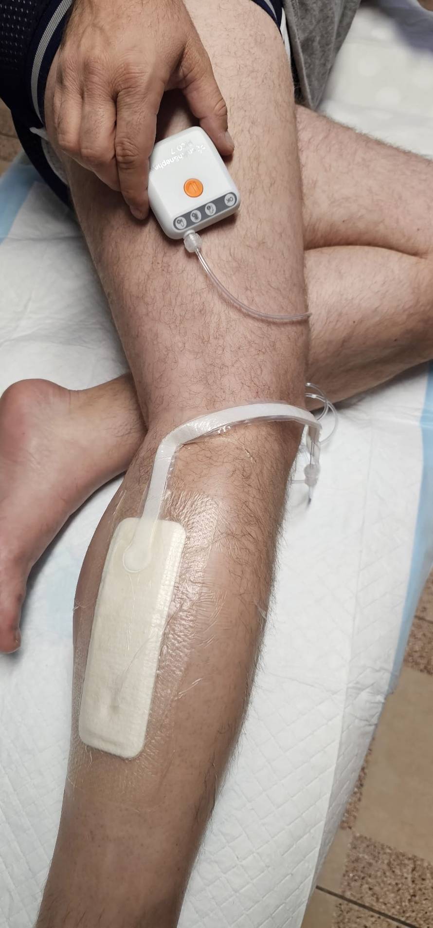 Ustanova iz malog mjesta, rezultati na svjetskoj razini