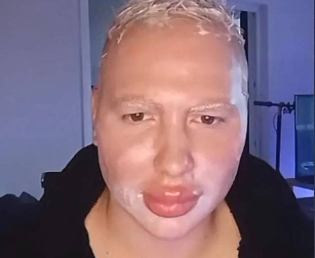 FOTO Sjećate li se Brendona iz BB-a? 'Estetske operacije su mi totalno upropastile lice...'