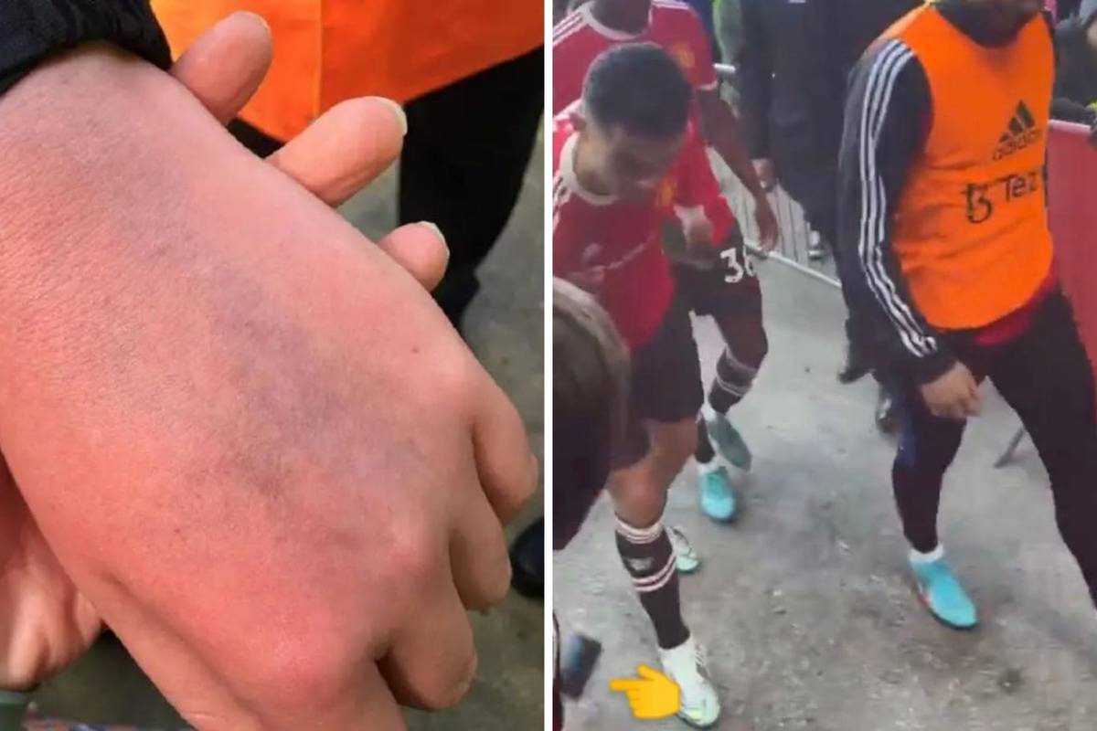 Majka autističnog dječaka: Zašto bismo prihvatili poziv, samo zato jer je on Ronaldo?