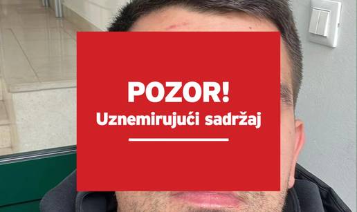 VIDEO Kaos u Orebiću: Šef kluba ugrizao suparnika za oko! Evo kako izgledaju napadnuti igrači