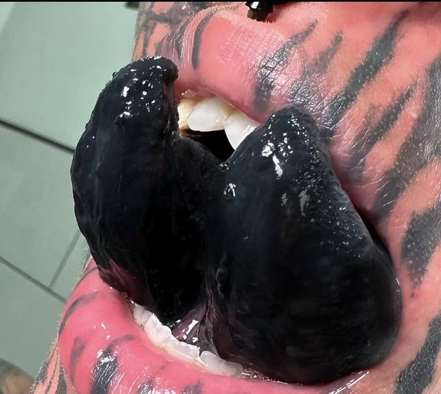 FOTO Uznemirujuće! Uklonila je čak i vrh nosa, a evo kako je izgledala: Šteta, ljepotica si bila