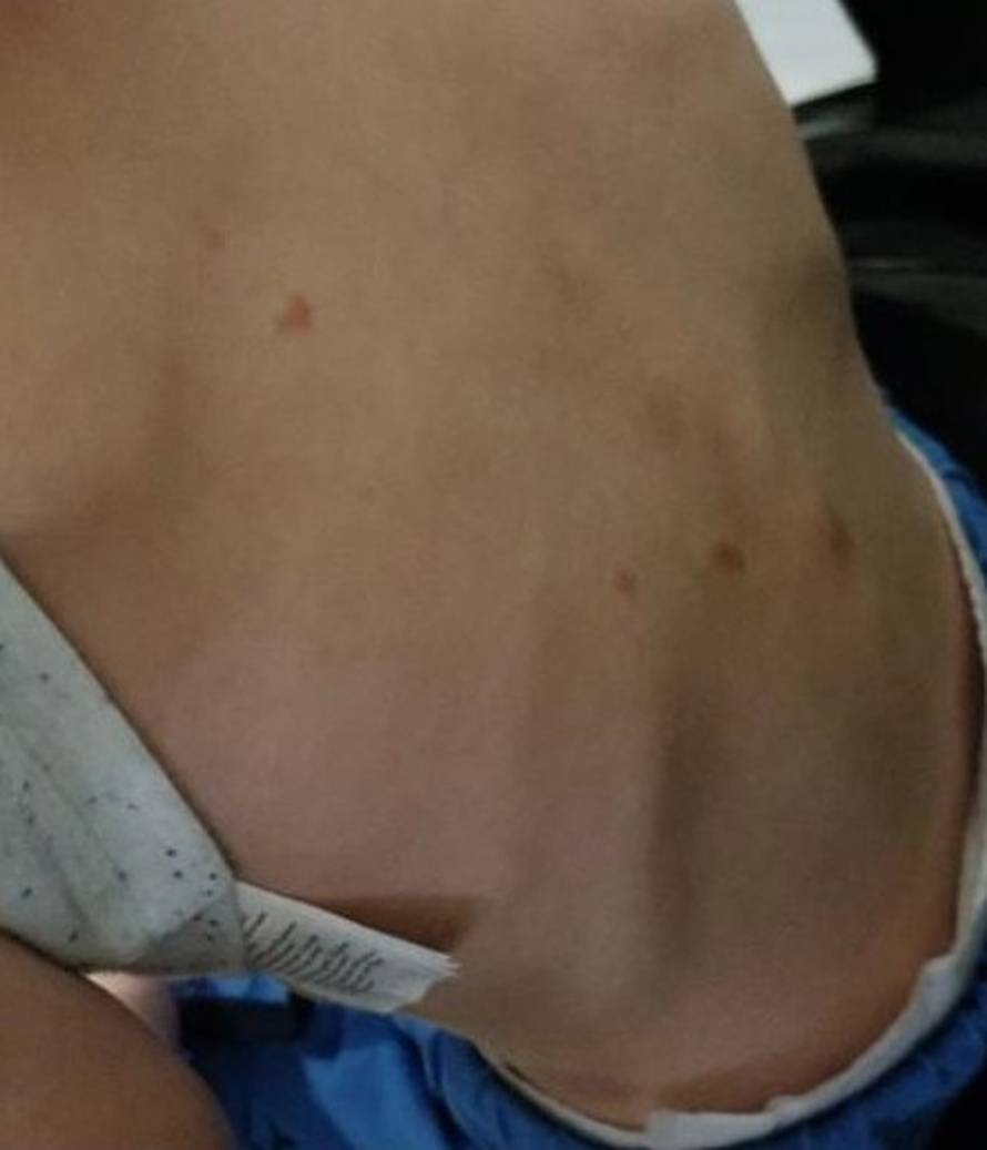 Dadilja zlostavljanog dječaka: 'Posvojili su me pa me izbacili'