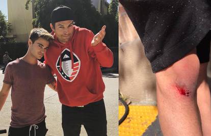 Ashton Kutcher autom udario tinejdžera i srušio ga na zemlju