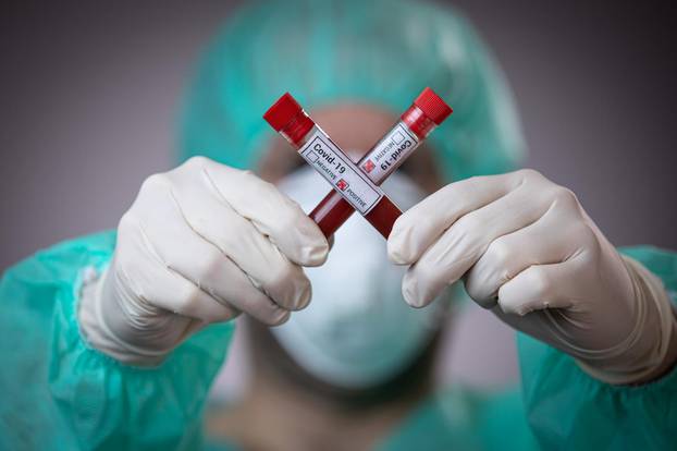 Epruvete s uzorcima krvi - testiranje na koronavirus
