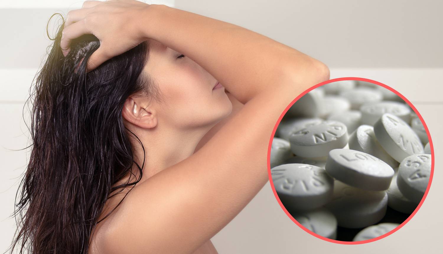 Top 10 problema koje aspirin rješava - perut, akne, mrlje...