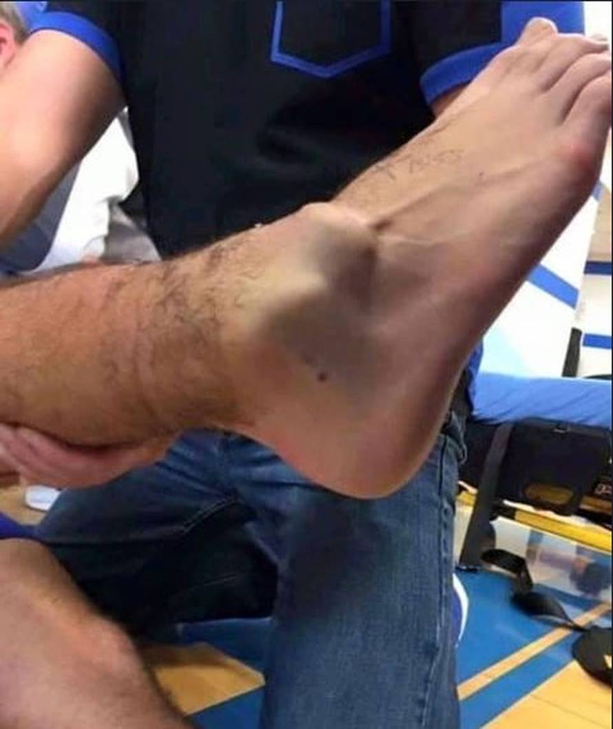 Slomio se jer je teško ozlijedio Gomesa, rasistički ga vrijeđali